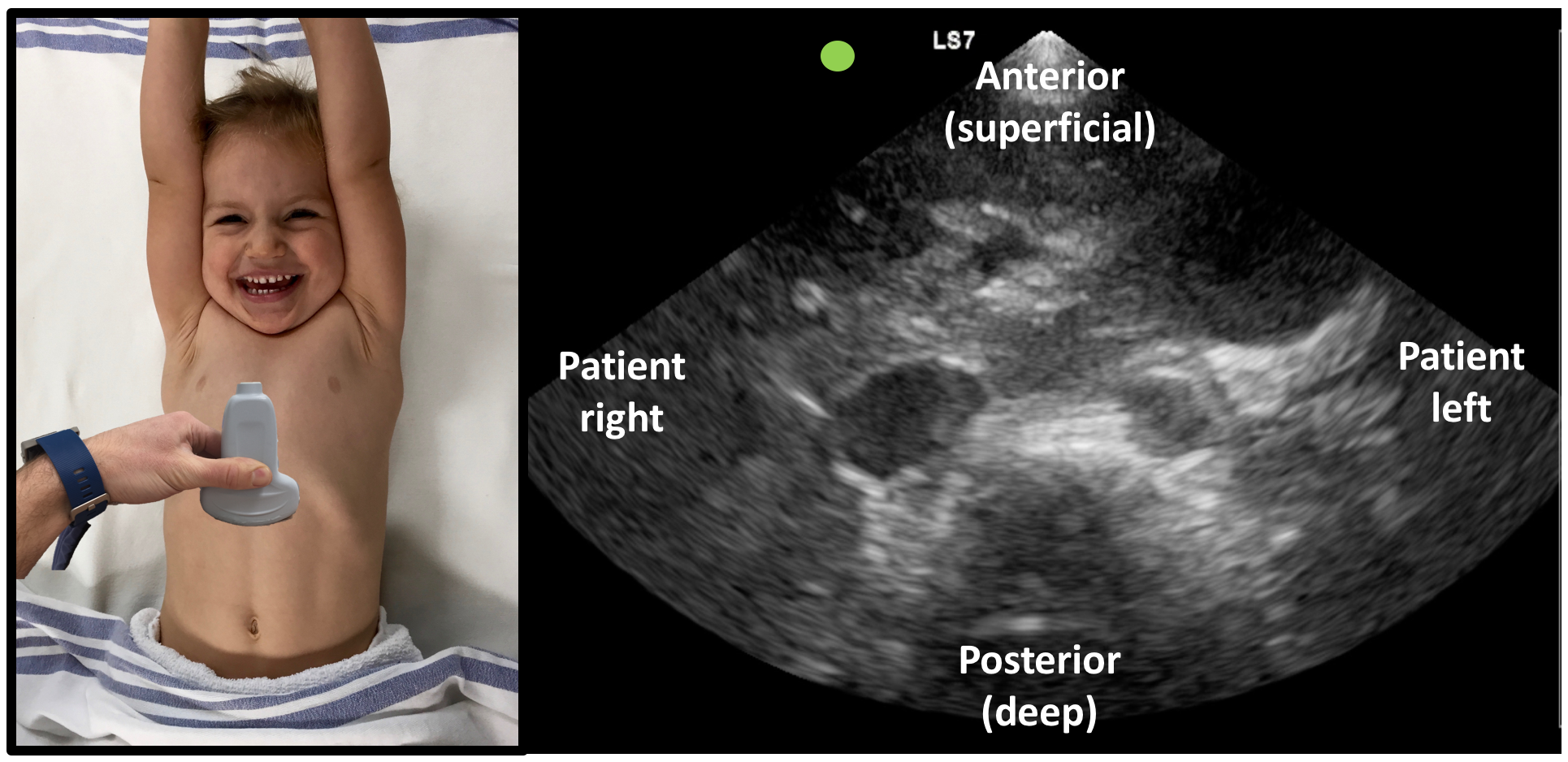 presentation ultrasound